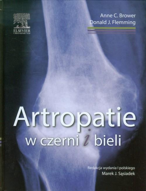 Artropatie w czerni i bieli  Brower Anne C., Flemming Donald J.-77665