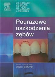 Pourazowe uszkodzenia zębów  Andreasen J.O., Bakland L.K., Flores M.T.-77865
