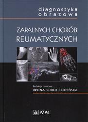 Diagnostyka obrazowa zapalnych chorób reumatycznych  Sudoł-Szopińska  Iwona-121629