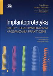 Implantoprotetyka Zalety przeciwwskazania rozwiązania praktyczne  Bruna Ezio, Fabianelli Andrea, Pavolucci Giulio-145845