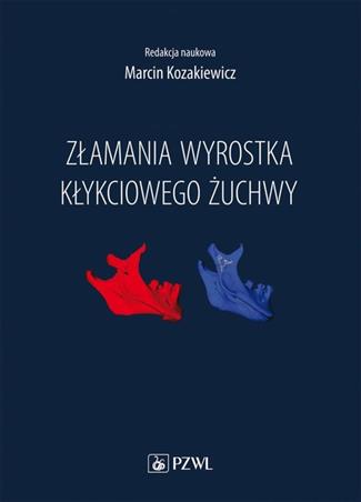 Złamania wyrostka kłykciowego żuchwy Kozakiewicz Marcin
