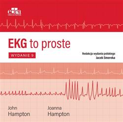 EKG to proste-306039