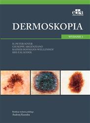 Dermoskopia-311995