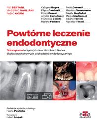 Powtórne leczenie endodontyczne P. Bertani, M. Gagliani , F. Gorni