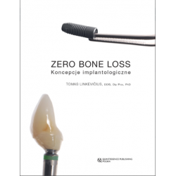 Zero Bone Loss - Koncepcje Implantologiczne