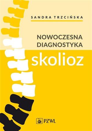 Nowoczesna diagnostyka skolioz Trzcińska, Koszela, Myśliwiec, Żurawski