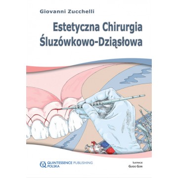 Estetyczna Chirurgia Śluzówkowo-Dziąsłowa Giovanni Zucchelli